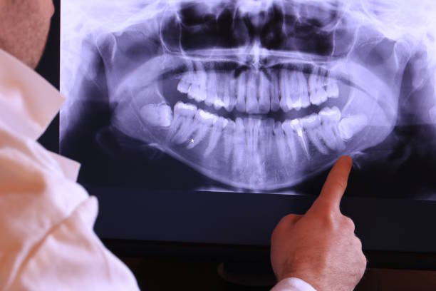 Best Emergency Dental Care for Sports Injuries in Almont, MI