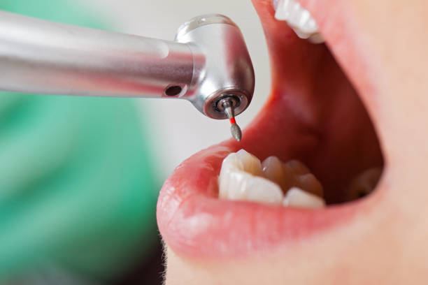 Best Emergency Care for Gum Disease in Almont, MI